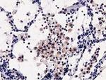 OSBPL11 Antibody in Immunohistochemistry (Paraffin) (IHC (P))