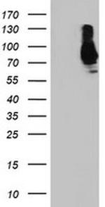 SAMHD1 Antibody in Western Blot (WB)