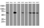 SAMHD1 Antibody in Western Blot (WB)