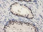 PYCRL Antibody in Immunohistochemistry (Paraffin) (IHC (P))