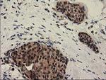 PYCRL Antibody in Immunohistochemistry (Paraffin) (IHC (P))