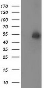 Syntrophin alpha-1 Antibody in Western Blot (WB)