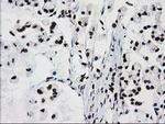 FKBPL Antibody in Immunohistochemistry (Paraffin) (IHC (P))