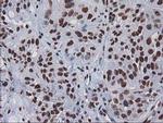 CTDSP1 Antibody in Immunohistochemistry (Paraffin) (IHC (P))