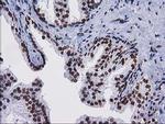 CTDSP1 Antibody in Immunohistochemistry (Paraffin) (IHC (P))