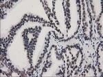 CTDSP1 Antibody in Immunohistochemistry (Paraffin) (IHC (P))