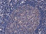 NUDT6 Antibody in Immunohistochemistry (Paraffin) (IHC (P))