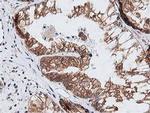 NUDT6 Antibody in Immunohistochemistry (Paraffin) (IHC (P))