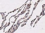 NUDT6 Antibody in Immunohistochemistry (Paraffin) (IHC (P))