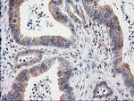 eIF4E2 Antibody in Immunohistochemistry (Paraffin) (IHC (P))