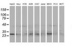 eIF4E2 Antibody in Western Blot (WB)