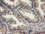 ACOT12 Antibody in Immunohistochemistry (Paraffin) (IHC (P))