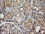 ACOT12 Antibody in Immunohistochemistry (Paraffin) (IHC (P))