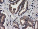 ACOT12 Antibody in Immunohistochemistry (Paraffin) (IHC (P))