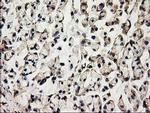 ACOT12 Antibody in Immunohistochemistry (Paraffin) (IHC (P))