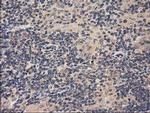 ACOT12 Antibody in Immunohistochemistry (Paraffin) (IHC (P))