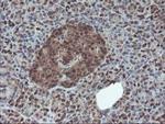 HDHD1 Antibody in Immunohistochemistry (Paraffin) (IHC (P))