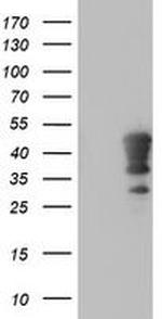 HOXC11 Antibody in Western Blot (WB)