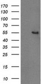 GBA3 Antibody in Western Blot (WB)