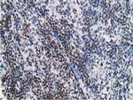 DCK Antibody in Immunohistochemistry (Paraffin) (IHC (P))