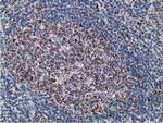 SSX1 Antibody in Immunohistochemistry (Paraffin) (IHC (P))