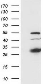 SSX1 Antibody in Western Blot (WB)