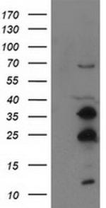 SSX1 Antibody in Western Blot (WB)