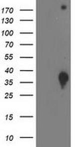 DNAJB2 Antibody in Western Blot (WB)