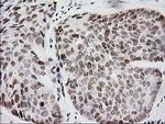 CRY2 Antibody in Immunohistochemistry (Paraffin) (IHC (P))