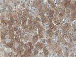 Aldolase B Antibody in Immunohistochemistry (Paraffin) (IHC (P))