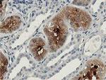 Aldolase B Antibody in Immunohistochemistry (Paraffin) (IHC (P))