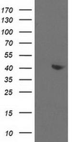 Aldolase B Antibody in Western Blot (WB)