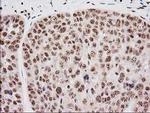 Monoacylglycerol Lipase Antibody in Immunohistochemistry (Paraffin) (IHC (P))