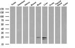 FGF21 Antibody in Western Blot (WB)