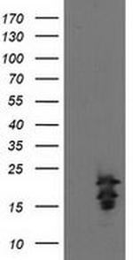 FGF21 Antibody in Western Blot (WB)