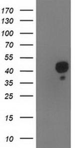 Nudel Antibody in Western Blot (WB)