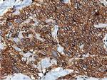 ILVBL Antibody in Immunohistochemistry (Paraffin) (IHC (P))