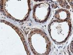 ILVBL Antibody in Immunohistochemistry (Paraffin) (IHC (P))