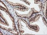 NUDT9 Antibody in Immunohistochemistry (Paraffin) (IHC (P))