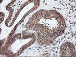 NUDT9 Antibody in Immunohistochemistry (Paraffin) (IHC (P))