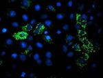 DLD Antibody in Immunocytochemistry (ICC/IF)