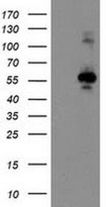 CCM2 Antibody in Western Blot (WB)