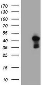 PDSS2 Antibody in Western Blot (WB)