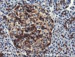 PFKP Antibody in Immunohistochemistry (Paraffin) (IHC (P))