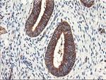 PFKP Antibody in Immunohistochemistry (Paraffin) (IHC (P))