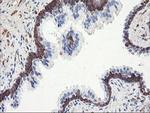 PFKP Antibody in Immunohistochemistry (Paraffin) (IHC (P))