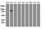 PFKP Antibody in Western Blot (WB)