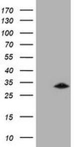 GSTO2 Antibody in Western Blot (WB)