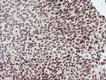 RNF113B Antibody in Immunohistochemistry (Paraffin) (IHC (P))