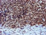 RFXANK Antibody in Immunohistochemistry (Paraffin) (IHC (P))